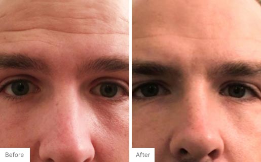 9 - Before and After Real Results of Age IQ Day Cream on a man's face